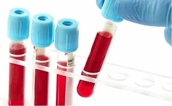 1490595454718169BkGE.jpg 未標(biāo)題-3.jpg