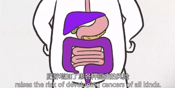 1511405420947340EBSN.jpg 19.jpg