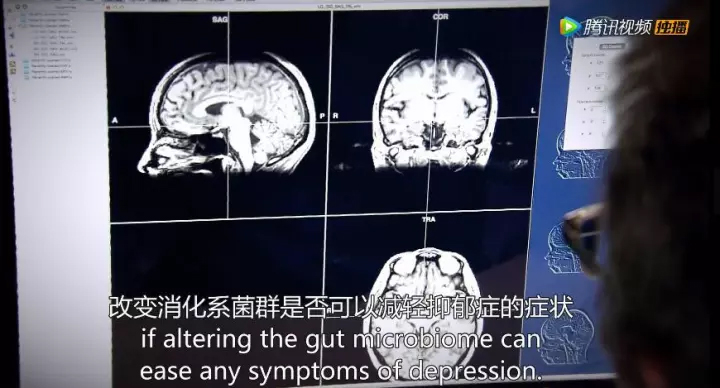 1511405690986290Zz9g.jpg 31.jpg