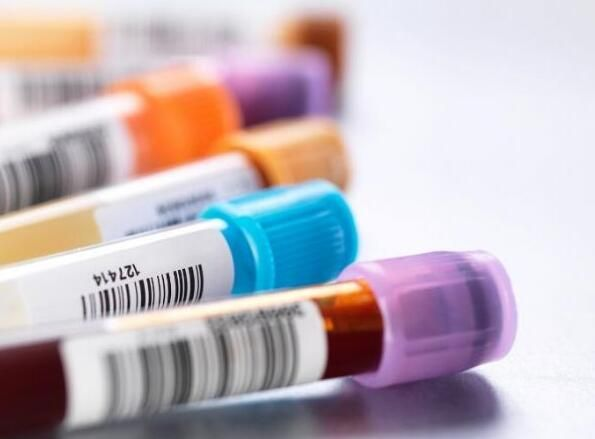 1514427977366384M37t.png 1.png